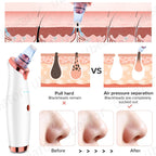 Electric USB Rechargeable Blackhead and Pore Remover